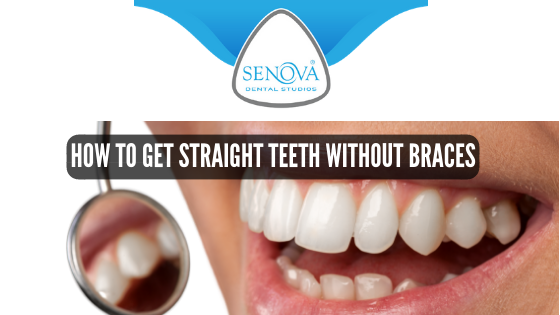 How to Get Straight Teeth without Braces – Senova Blog