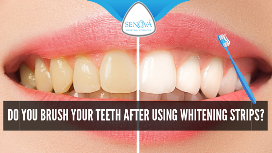 do crest 3d white strips work after one use