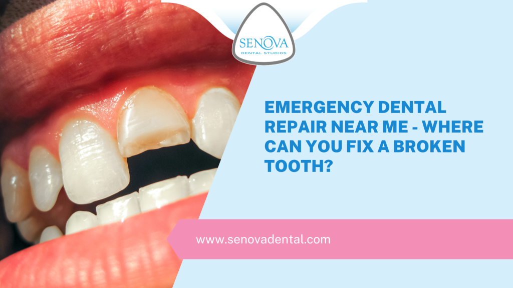 How To Remove Plaque From Teeth – Senova Blog