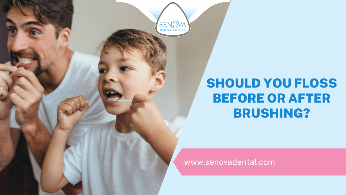 Should You Floss Before Or After Brushing?